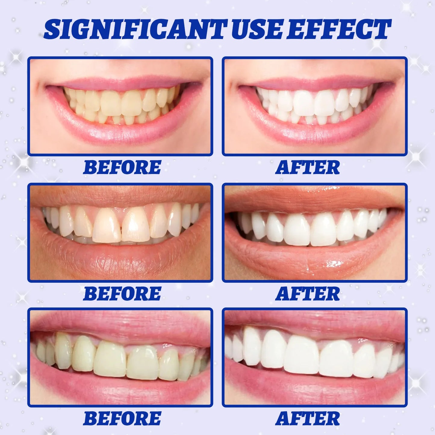 5D Teeth Whitening Strips Gel Remove Plaque Stains Cleaning Oral Hygiene Bleaching Dental Tools Fresh Breath Brighten Tooth Care