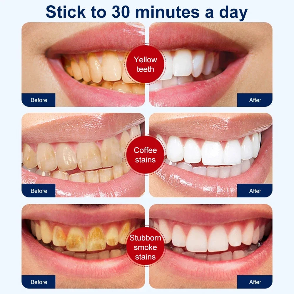 5D Teeth Whitening Strips Gel Remove Plaque Stains Cleaning Oral Hygiene Bleaching Dental Tools Fresh Breath Brighten Tooth Care